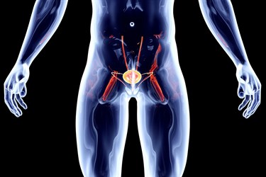 Рак предстательной железы (опухоль) у мужчин: симптомы и причины